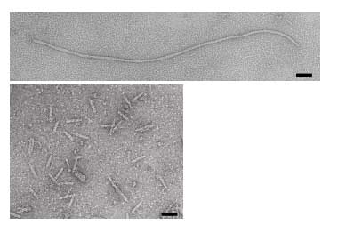 Electron micrographs of microphage described by Specthrie