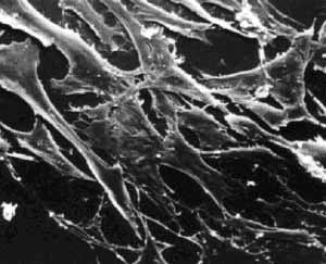 Normal Mouse Fibroblasts.