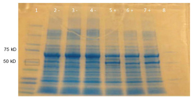 Photo of a blue-stained electrophoresis gel.