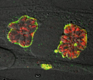 Infected cells viewed under a microscope, shown as amorphous blobs colored bright red, yellow, and green. 