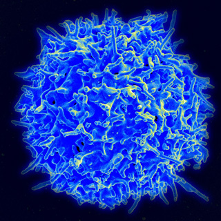 A scanning electron micrograph of a human T cell. The cell appears as a a blue sphere with irregularly shaped points protruding from it.