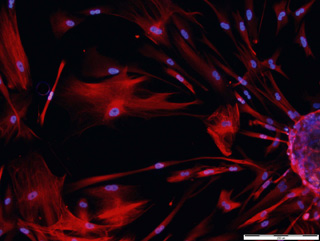 Neural progenitor cells shown as circular nuclei stained in blue, inside long lines of proteins stained in red.