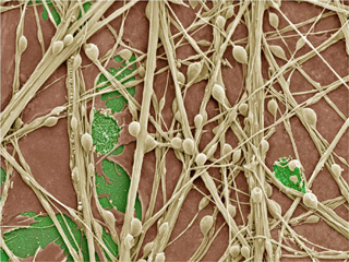 Nerve cells grown in culture as seen under a microscope. Nerve cells appear as tan threads on a brown background. Round tan beads on these threads are the synapses, the connections between nerve cells.