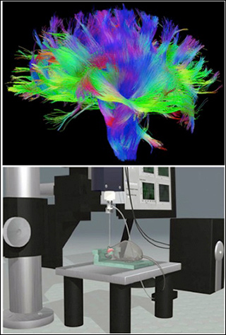 Top image is a colorful illustration of some of the connections in the human brain, while the bottom schematic shows the design of the Autopatcher apparatus.