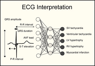 A diagram showing how to interpret the results of an ECG.