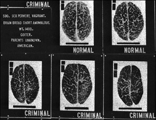Set of photographs of brains labeled 'normal' and 'criminal'.