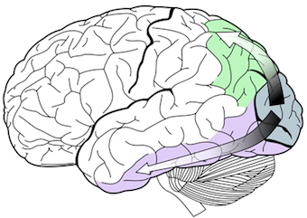Diagram of human brain with two arrows emerging from the rear (occipital lobe). The ventral stream goes to the side, along the temporal lobe, and the dorsal stream goes toward the top of the brain.